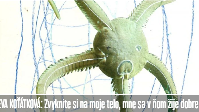 Ranní ladění na rádiu Devín o výstavě Zvykněte si na mé tělo, mně se v něm žije dobře